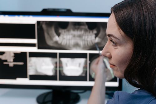 X-rays using AI